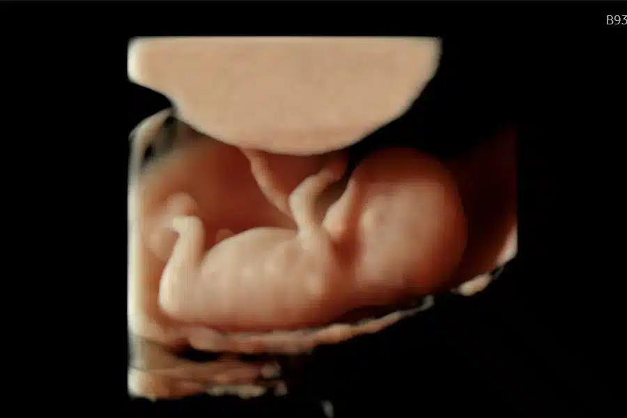 Tidlig 3D scanning uge 11
