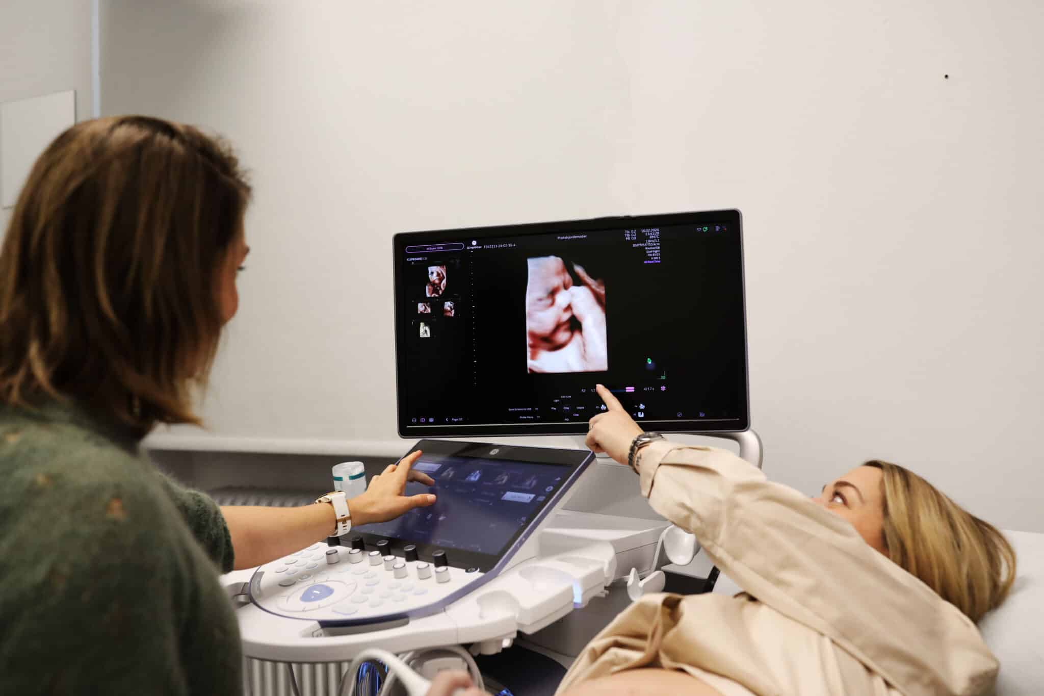 3D scanning ansigt peger