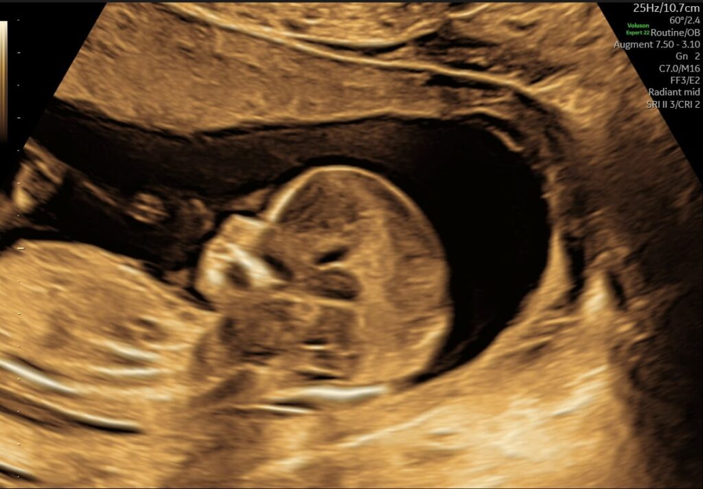 Scanning uge 13